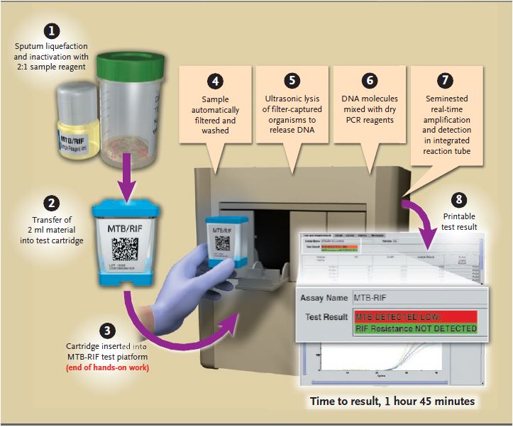 http://www.finddiagnostics.org/export/sites/default/programs/tb/images/xpert/xpert_mtb-rif_procedure.JPG